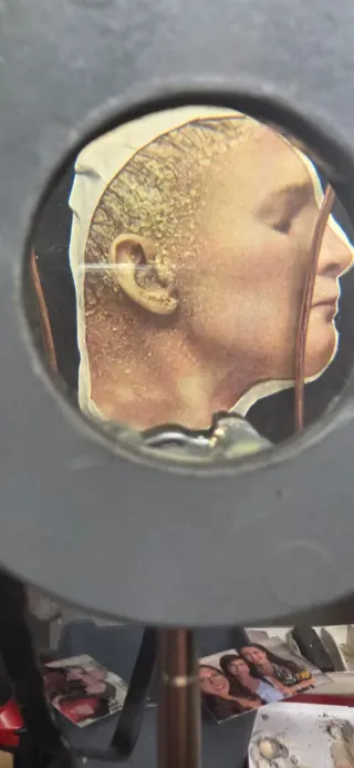 Visore con immagini mediche di malattie