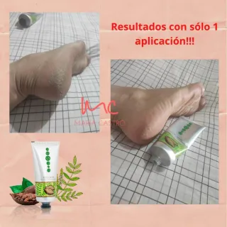 Crema para pies con Boswellia y cocoa