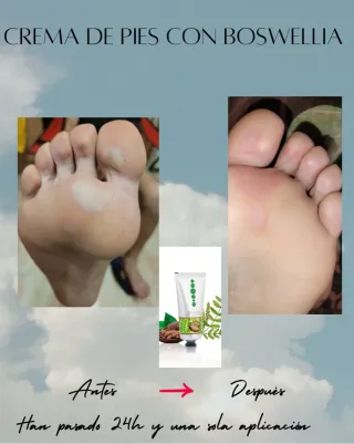 Crema para pies con Boswellia y cocoa