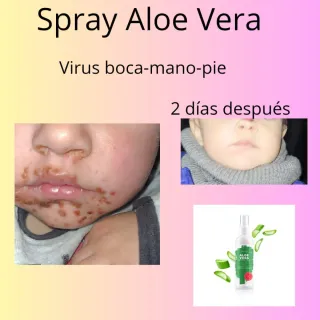 Spray Aloe Vera Soft Essens