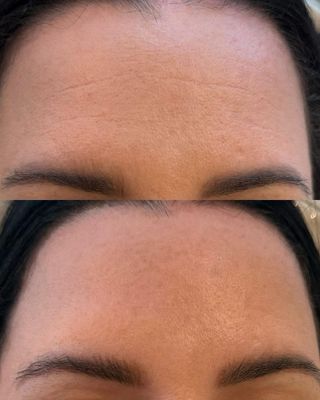 Nanoterapia Facial, Capilar y Corporal