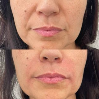 Nanoterapia Facial, Capilar y Corporal