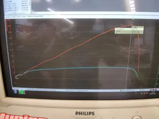 Kawasaki ZX-10R Circuito