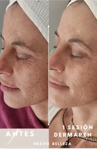 Limpieza facial y diagnóstico en Sant Feliu