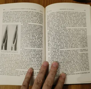 Transfusión de sangre. Libro medico antiguo 1953