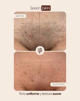 Rasurados para hombres y mujeres