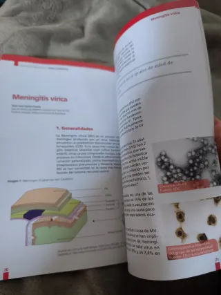 Meningitis aguda en la edad pediátrica