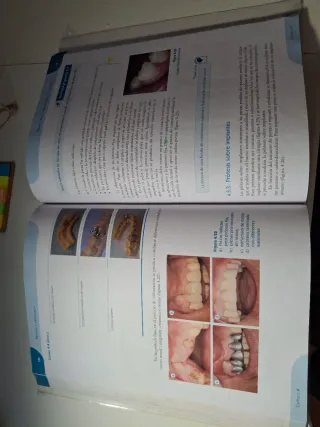 Libro Prótesis y ortodoncia Editorial Sintesis