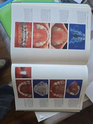Van Waes, H.J.M., Atlas de odontología pediátri...