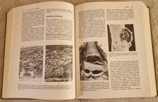 Patología de Muir compendio de anatomía patológ...