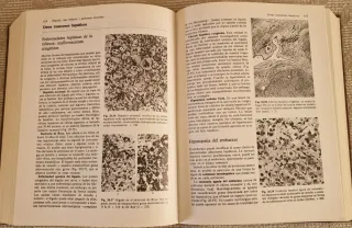 Patología de Muir compendio de anatomía patológ...