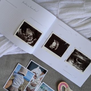 Libro de recuerdos para bebés