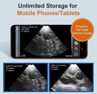 Scanner veterinario per gravidanze animali nuovo