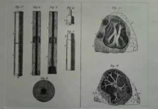 Grabados de la medicina antigua de J. Uriach