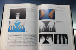 Atlas de Reumatología del Adulto. Laboratorios Almirall S.A., 1993.