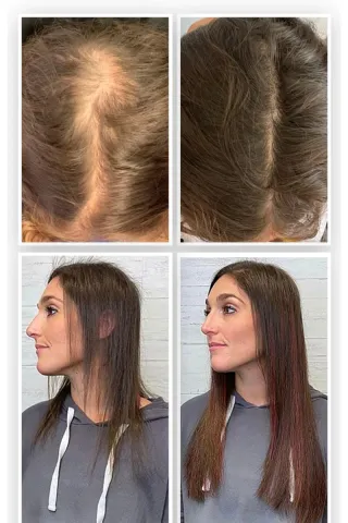 Champú SimyCare Crecimiento Rápido 6cm/Mes