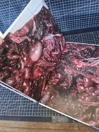 Adriana Varejão chambre d'échos