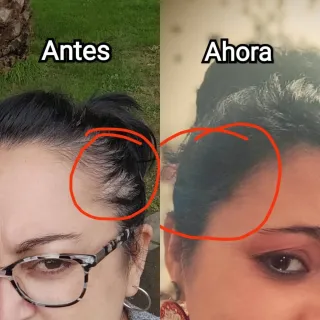 Monat IR Clinical Cuidado Capilar Antienvejecimien