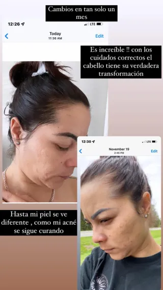 Monat IR Clinical Cuidado Capilar Antienvejecimien