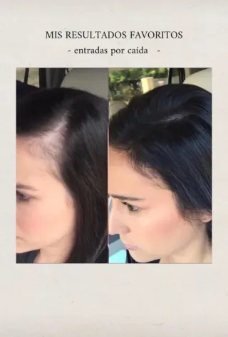 Monat IR Clinical Cuidado Capilar Antienvejecimien