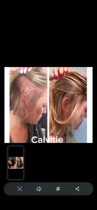 Monat IR Clinical Cuidado Capilar Antienvejecimien