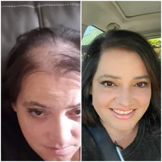 Monat IR Clinical Cuidado Capilar Antienvejecimien