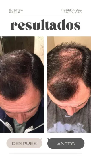 Monat IR Clinical Cuidado Capilar Antienvejecimien