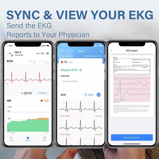 CheckMe DuoEK-S - Monitor Oximetro ECG Portatile