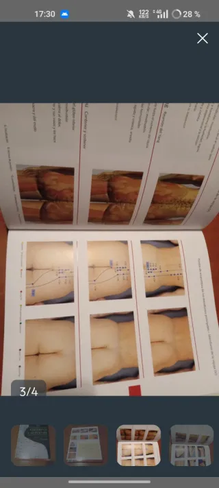 Atlas Gráfico de Acupuntura