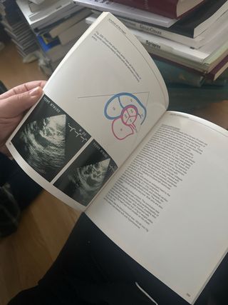 Ecocardiography- Boehringer Ingelheim