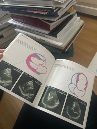 Ecocardiography- Boehringer Ingelheim