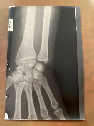 Foto de Radiografía antigua 52168 M M