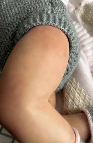 Bebé Reborn Hiperrealista