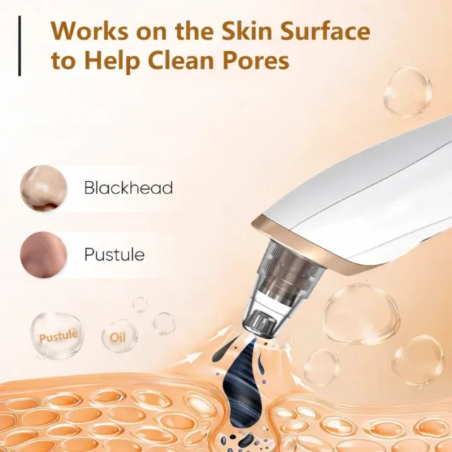 Aspirador facial puntos negros Limpieza profunda