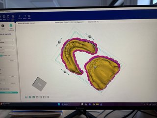 NextDent LCD1 Impresora 3D