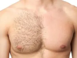 Depilación integral masculina con crema a domicili