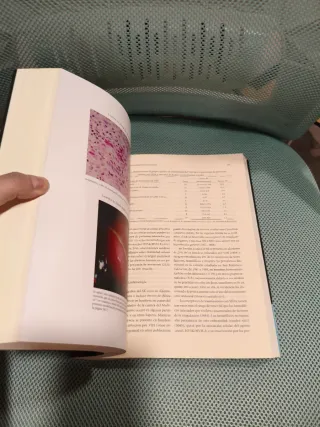 El Vih y la Patogénesis del Sida