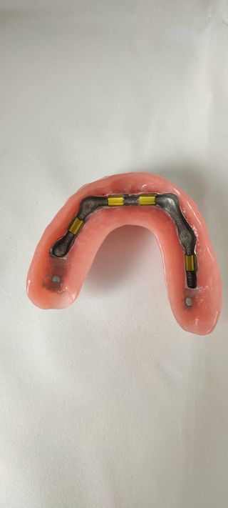 Prótesis dental