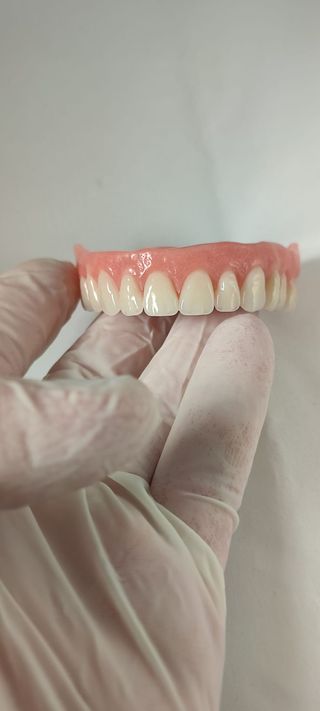 Prótesis dental