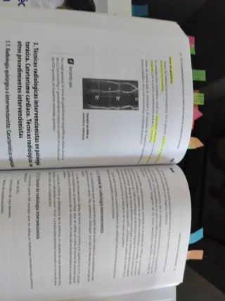 Técnico/a Especialista en Radiodiagnóstico de I...