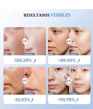 Aparato Radiofrecuencia Facial Oro Rosa