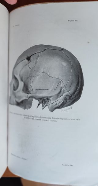 Tratado de Medicina Legal