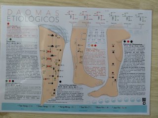 Pósters de Iridiologia, Auriculoterapia...