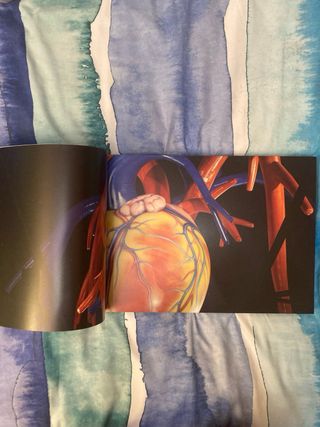 Libro de arte Plensa 58 Artika
