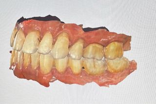 Medit i700 Escáner Intraoral
