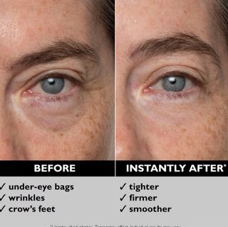 Peter Thomas Roth Instant Firm X Eye 30ml USA