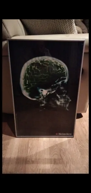 Cuadro Bar Heineken Cerebro Rayos X