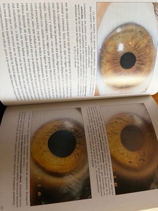 El gran libro de la iridología: el iris de los ...