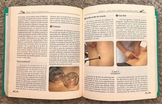 Artritis. Ayuda de la Medicina China