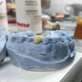 10 Sobres Alginato Cromático Dental 450gr